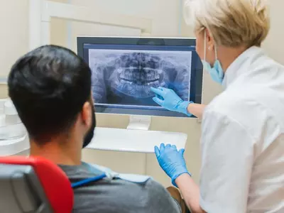 잇몸병 앓으면 암에 걸릴 위험 13% 높아… 혈액암은 40% ↑