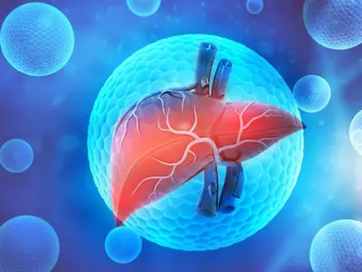 ‘비알코올성 지방간염’혈액검사만으로 진단 가능