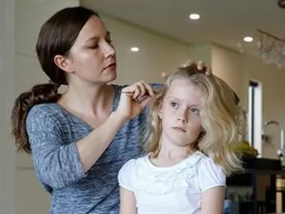 소아과학회 "머릿니 감염, 건강 위험·위생 불량 징후 아냐"