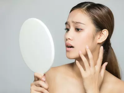 “얼굴에 점이 생겼네”피부암, 5년 새 40% 증가