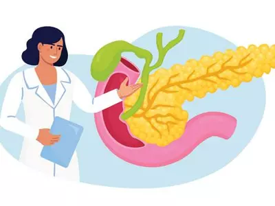 대사증후군 지속 노출되면 췌장암 위험 높아져