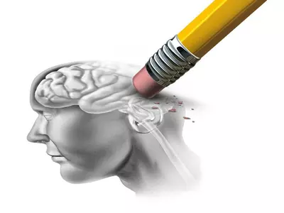 [의학카페] ‘치매 발병 수십년 전 예측’ 진단법 개발