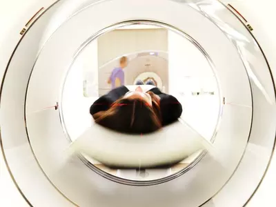 단순 두통 때문에 MRI 촬영하면‘검사비 폭탄’맞을 수도