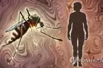 플로리다·텍사스주에서 20년 만에 말라리아 지역내 감염 발생
