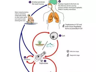 네바다주서 두 살 아이 '뇌 먹는 아메바' 감염 사망