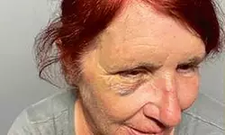 “도둑 제지하고 폭행 당했는데 해고”