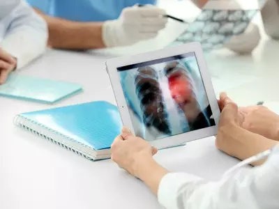 ‘면역 항암제’돌연변이 양성 폐암에도 효과