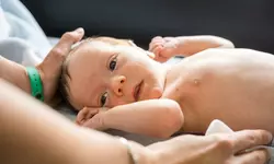 미국 '선천성 매독' 신생아 급증