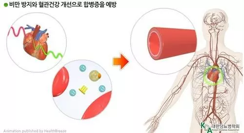 운동의 당뇨병 합병증 예방효과
[대한당뇨병학회 제공]