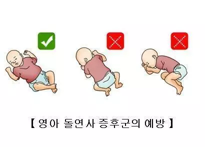 영아 돌연사 증후군 예방을 위한 수면 자세[서울아산병원 제공. 재판매 및 DB 금지]