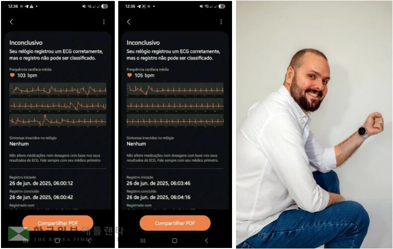 갤럭시 워치 착용한 호베르투 갈라르트(오른쪽)와 그의 심전도 측정 데이터
[삼성전자 중남미총괄 제공. 재판매 및 DB 금지]