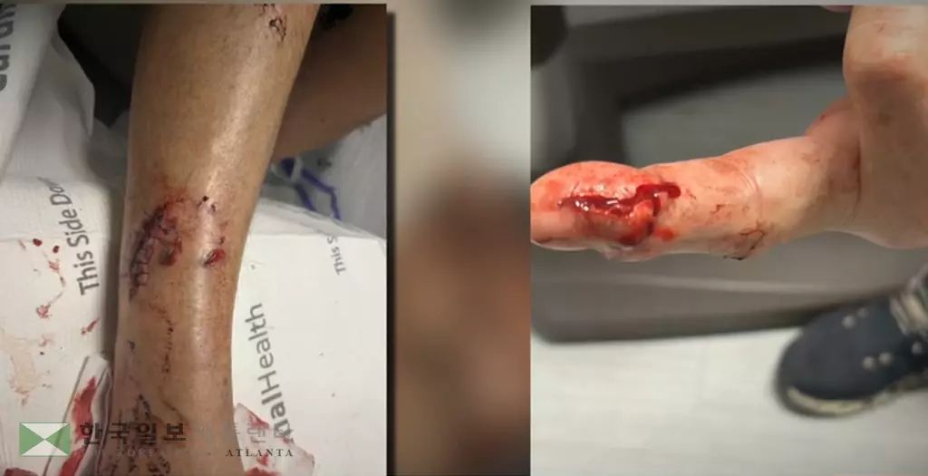 지난 12월 26일 뷰포드 주민이 반려견과 산책 중 코요테에 발과 손가락을 물려 부상을 입었다. 검사 결과 광견병 양성판정이 나왔다.<사진=ANF>