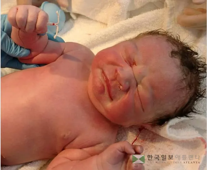 '갓 태어난 아기 손에 피임기구가 들려있네...'