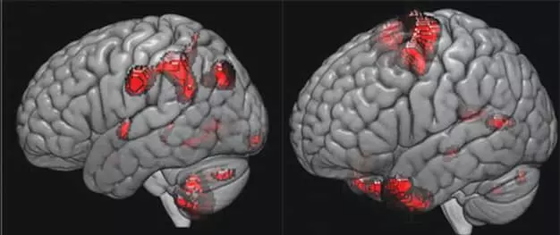 '사람마다 IQ 다른 이유' 세계 첫 규명