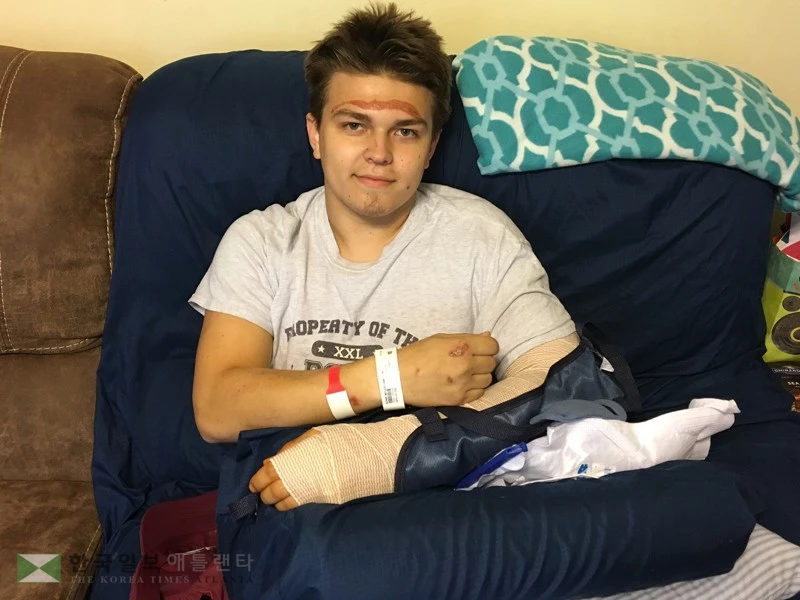 학생 치고 차만 살피고 뺑소니 친 여성 운전자