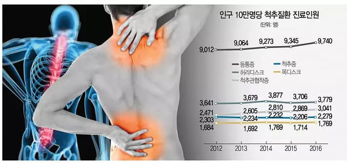 연간 800만명 괴롭히는 척추질환 연령마다 단골 부위 따로 있다는데…