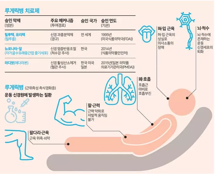 가장 잔인한 병, 루게릭…“혈액으로 병 진행 예측가능”