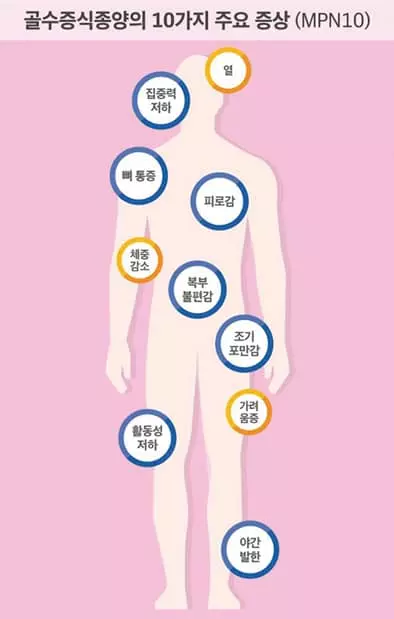 골수가‘열일’해서 생기는 병…‘골수섬유증’