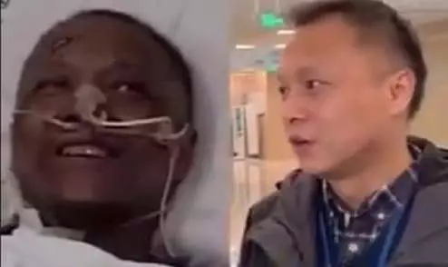 '까맸던 얼굴이' 코로나 극한 투병 중국인 의사 회복