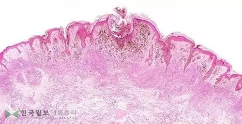 모든 암의 공유 단백질 발견