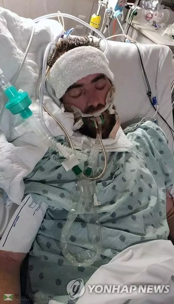 앨라배마주에서 백신을 접종받지 않은 30대 남성 조시 타이드모어가 자녀 셋을 남기고 코로나19로 사망했다. 사진은 지난 11일 앨라배마주 보아스의 병원에서 치료를 받고 있는 타이드모어의 생전 모습. [AP=연합뉴스]