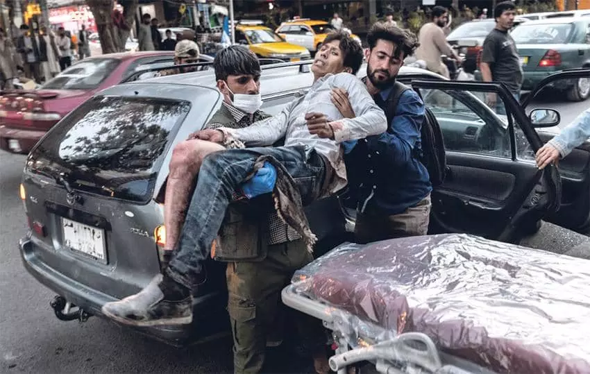 카불공항 근처에서 발생한 연쇄테러로 부상한 아프간 피란민[AFP=연합뉴스]