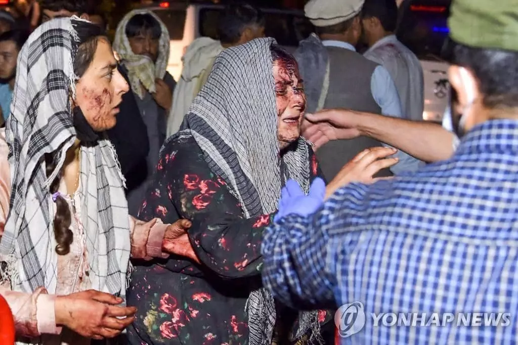 카불공항 근처에서 발생한 연쇄테러로 부상한 아프간 피란민[AFP=연합뉴스]