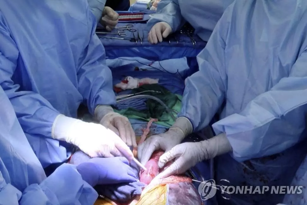 '돼지 신장 인체 이식' 수술하는 앨라배마대 의료진
