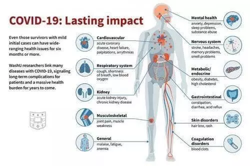 코로나19 회복 6개월 이내에 나타날 수 있는 후유증[세인트루이스 워싱턴 의대 Sara Moser 제공. 재판매 및 DB 금지]