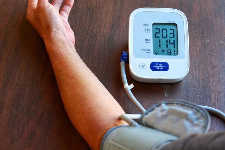 20세 이상 고혈압 환자는 29%로 3명중 1명꼴이지만 치료율은 63%, 조절률은 47%에 그치고 있다.   