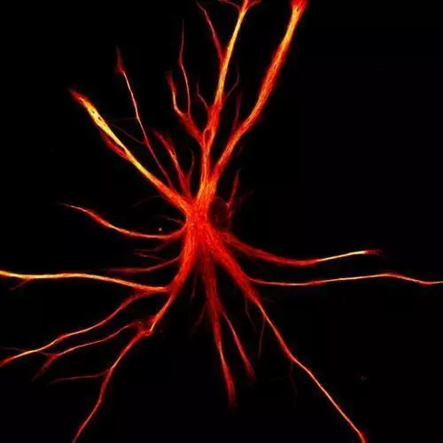 유도만능줄기세포(iPSCs)에서 유래한 성상교세포뇌에 흔한 성상교세포(astrocytes)는 노폐물 제거, 세포 포식, 신경조직 복구 등에 관여한다.
성상교세포는 수면의 양과 질을 제어하는 데도 중요한 역할을 한다.

그런데 신경 퇴행 질환이 생기면 성상교세포가 뉴런을 죽이기도 한다.
[뉴욕 줄기세포 재단 연구소 제공. 재판매 및 DB 금지]