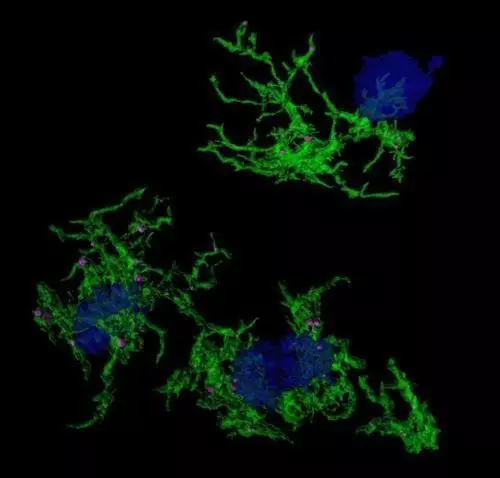 소교세포의 아밀로이드 포식
알츠하이머병의 주요 원인 물질인 아밀로이드 플라크(청색)를 뇌에서 포식하는 소교세포(녹색).
[싱가포르 Duke-NUS Medical School / 재판매 및 DB 금지]