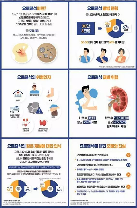 출산통 같은 옆구리 고통이…여름철 복병‘요로결석’