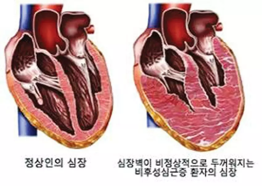   <서울대병원 제공>