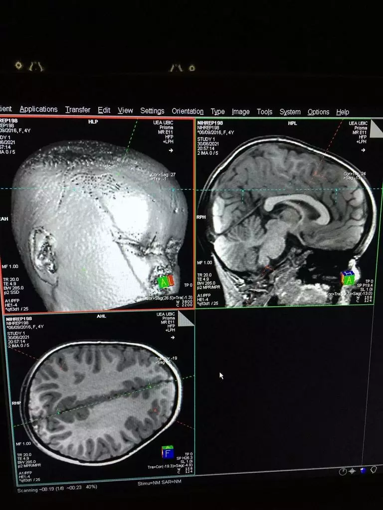 잠자는 동안 촬영한 유아 뇌 MRI 사진[University of East Anglia 제공]