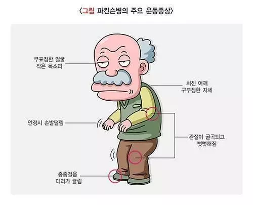 파킨슨병 주요 운동 증상[질병관리청 국가건강정보포털 제공. 재판매 및 DB 금지]